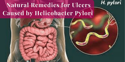 Read more about the article How to Use Natural Remedies for Ulcers Caused by Helicobacter Pylori – Gingivitis Remedy