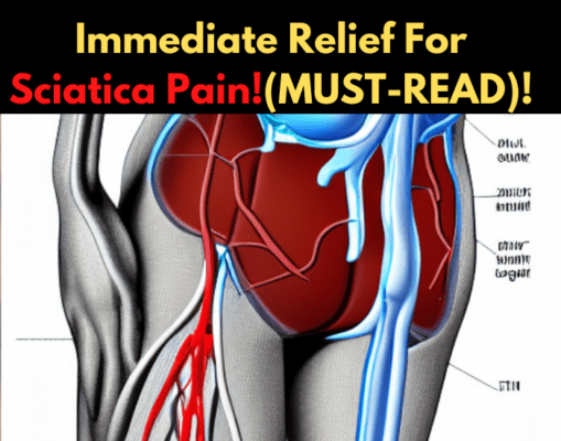 Read more about the article Get Immediate Relief For Sciatica Pain- Most Effective Remedy