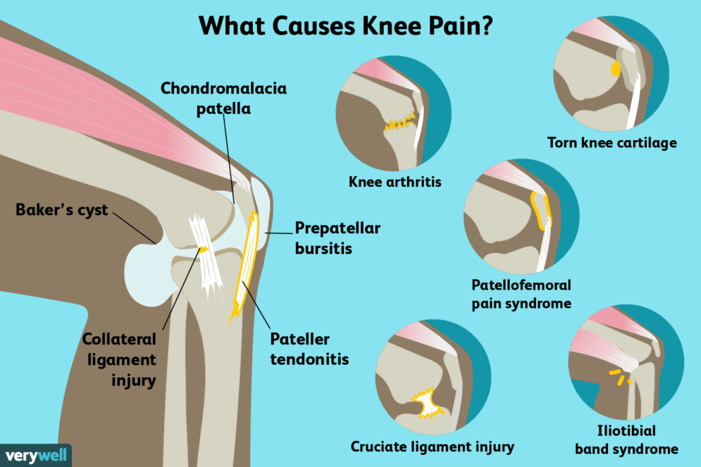 Joint Pain Review