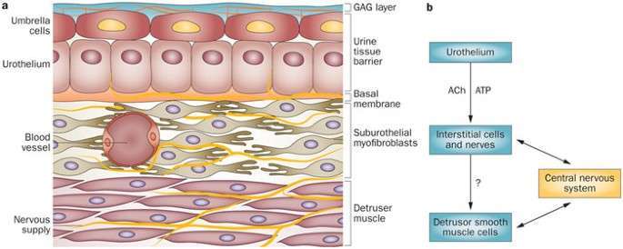 Dimethylsulfoxid for Interstitial Cystitis Review