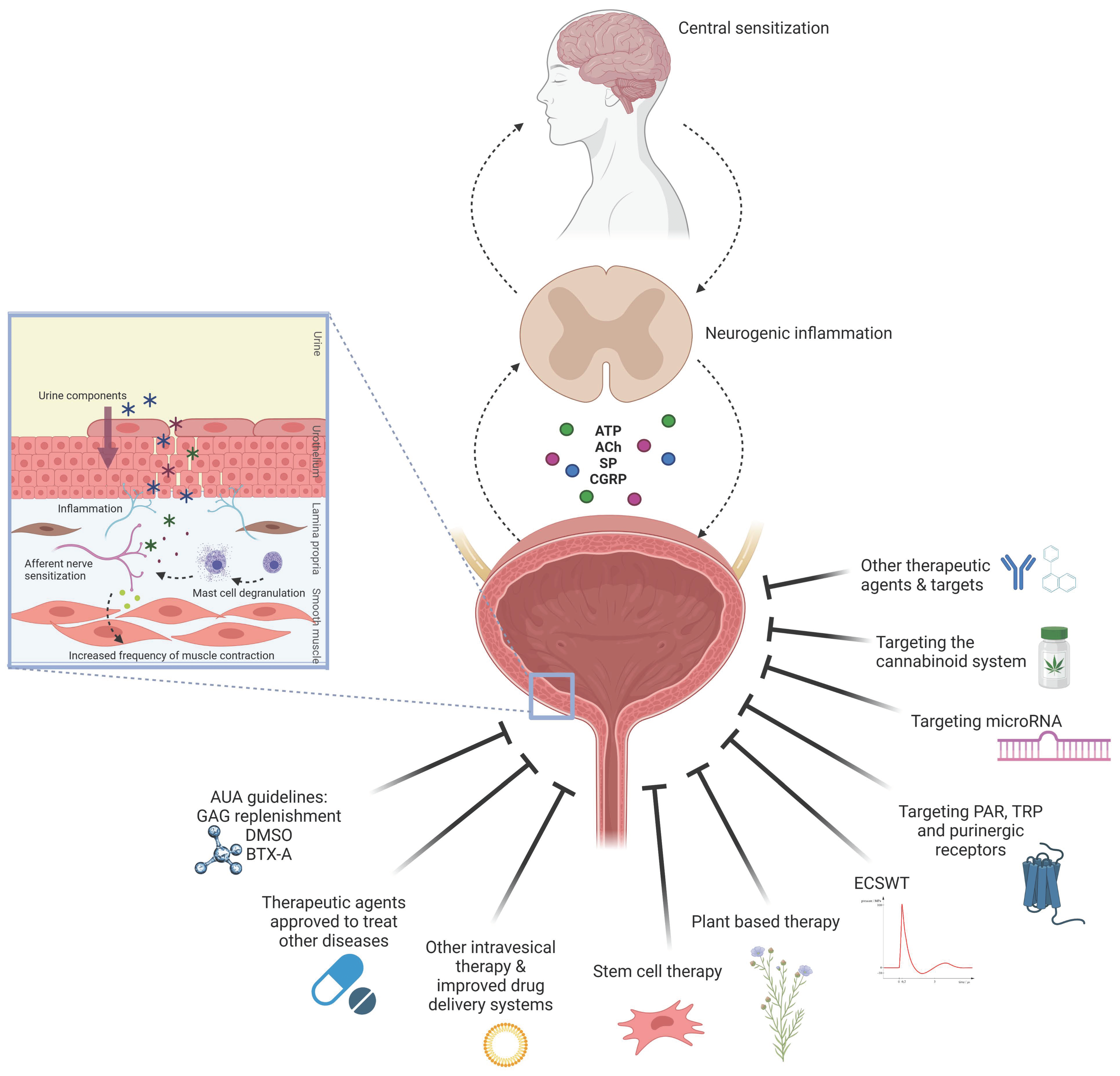 Dimethylsulfoxid for Interstitial Cystitis Review